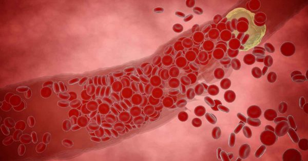 How to Clean Your Arteries With One Simple Fruit - Energy Therapy